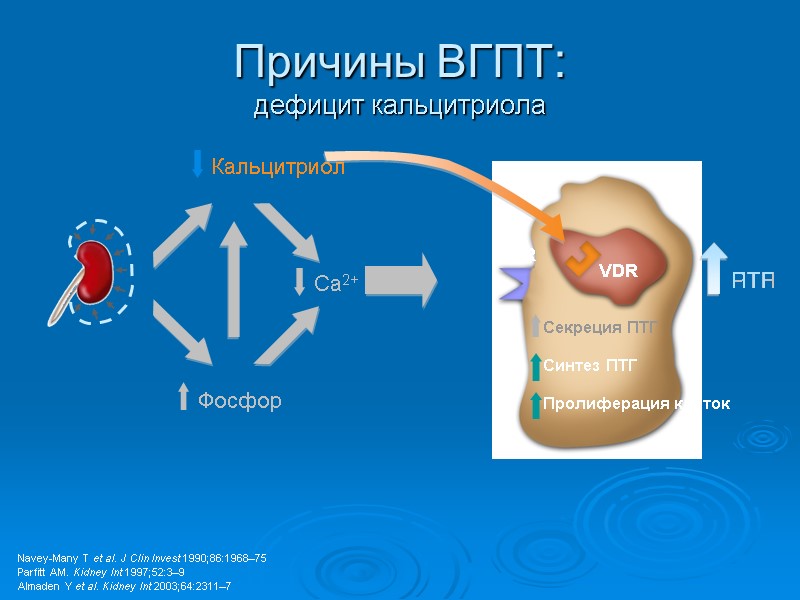 Причины ВГПТ: дефицит кальцитриола Navey-Many T et al. J Clin Invest 1990;86:1968–75 Parfitt AM.